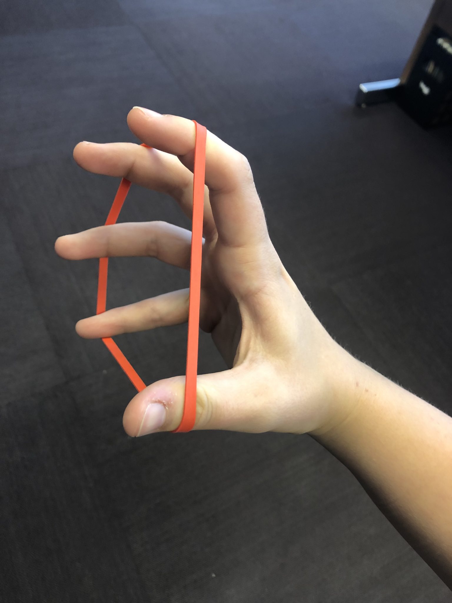 What Causes Thumb Pain & How to Reduce It Alaska Hand Rehabilitation