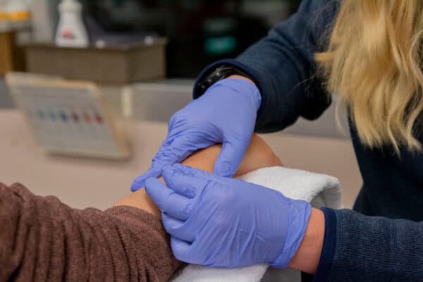 Dry Needling