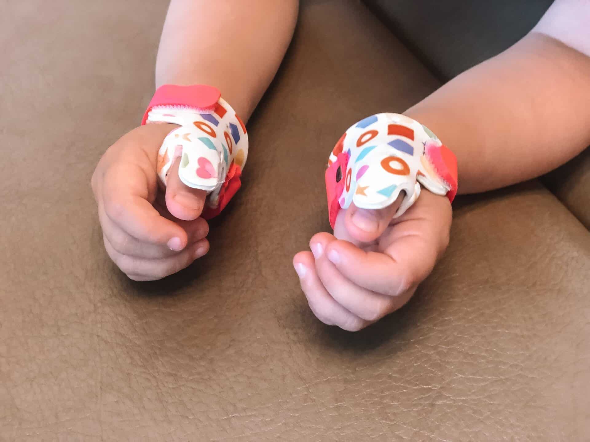 Child's hands with colorful splints for thumb injury recovery.