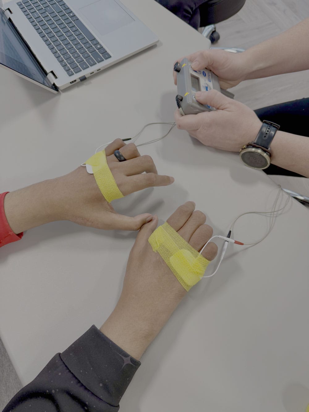 Hand rehabilitation session using electronic devices for recovery and therapy.